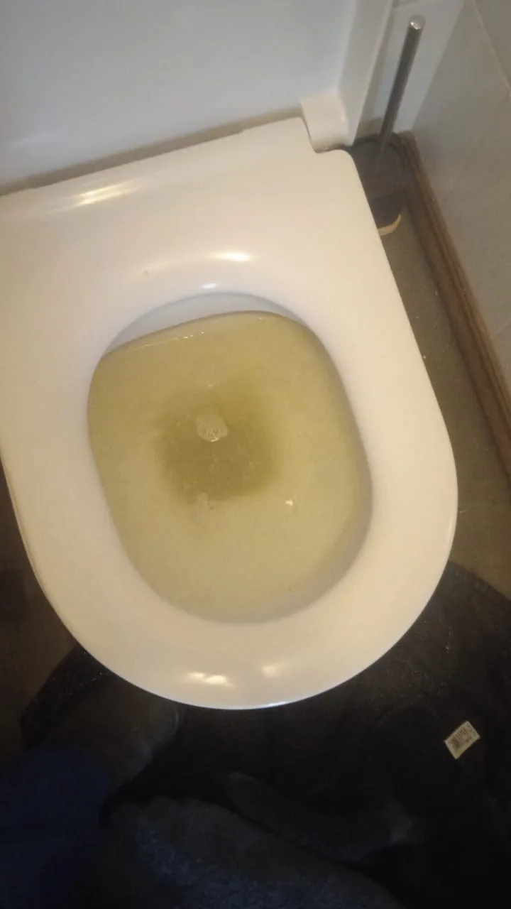 Blocked toilet bowl with standing water before toilet drain clearing